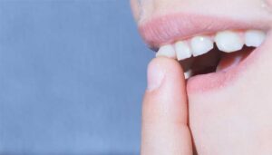 لق شدن دندان در بزرگسالی و راه های درمان آن