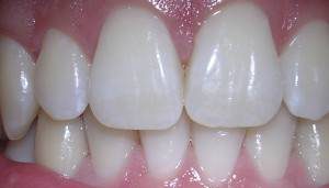 دستور ابوعلی سینا برای داشتن دندان های زیبا