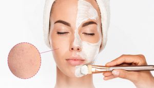 کاربردی ترین روش ها برای پاکسازی منافذ پوست